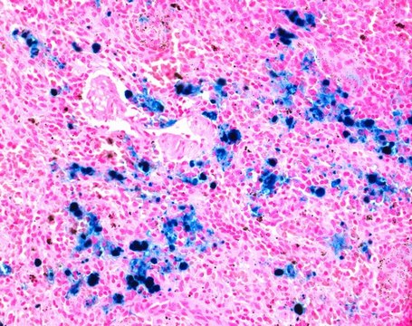 ISOSLIDE&#8482; Iron Control Slides with reference tissue for the detection of free iron in histological tissue
