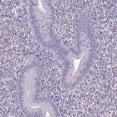 Anti-SLC30A3 antibody produced in rabbit Prestige Antibodies® Powered by Atlas Antibodies, affinity isolated antibody, buffered aqueous glycerol solution