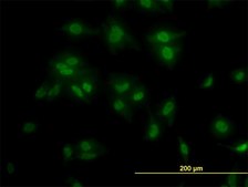 Monoclonal Anti-TCF7L2, (C-terminal) antibody produced in mouse clone 3A4, purified immunoglobulin, buffered aqueous solution