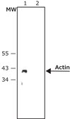 Monoclonal Anti-Rabbit Immunoglobulins−Alkaline Phosphatase antibody produced in mouse clone RG-16, purified immunoglobulin, buffered aqueous glycerol solution