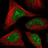 Anti-HDDC2 antibody produced in rabbit Prestige Antibodies® Powered by Atlas Antibodies, affinity isolated antibody, buffered aqueous glycerol solution