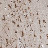 Anti-WWP1 antibody produced in rabbit Prestige Antibodies® Powered by Atlas Antibodies, affinity isolated antibody, buffered aqueous glycerol solution