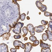 Anti-EGFR antibody produced in rabbit Ab1, Prestige Antibodies® Powered by Atlas Antibodies, affinity isolated antibody, buffered aqueous glycerol solution