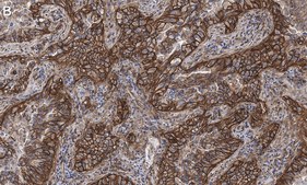 抗インテグリン pan-αV抗体 クローンEM01309 ZooMAb® ウサギ・モノクローナル recombinant, expressed in HEK 293 cells