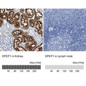 Anti-DPEP1 antibody produced in rabbit Prestige Antibodies® Powered by Atlas Antibodies, affinity isolated antibody, buffered aqueous glycerol solution
