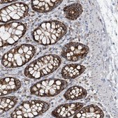 Anti-PNPT1 antibody produced in rabbit Prestige Antibodies® Powered by Atlas Antibodies, affinity isolated antibody, buffered aqueous glycerol solution
