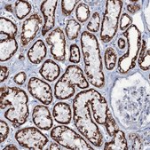 Anti-MRPS35 antibody produced in rabbit Prestige Antibodies® Powered by Atlas Antibodies, affinity isolated antibody, buffered aqueous glycerol solution