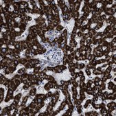 Anti-ACADS antibody produced in rabbit Prestige Antibodies® Powered by Atlas Antibodies, affinity isolated antibody, buffered aqueous glycerol solution, Ab2