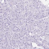 Anti-SLC8A2 antibody produced in rabbit Prestige Antibodies® Powered by Atlas Antibodies, affinity isolated antibody, buffered aqueous glycerol solution