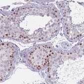 Anti-ZKSCAN2 antibody produced in rabbit Prestige Antibodies® Powered by Atlas Antibodies, affinity isolated antibody, buffered aqueous glycerol solution
