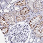 Anti-ACAD11 antibody produced in rabbit Prestige Antibodies® Powered by Atlas Antibodies, affinity isolated antibody, buffered aqueous glycerol solution