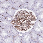 Anti-LIMS2 antibody produced in rabbit Prestige Antibodies® Powered by Atlas Antibodies, affinity isolated antibody, buffered aqueous glycerol solution