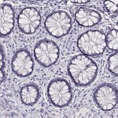 Anti-CRX antibody produced in rabbit Prestige Antibodies® Powered by Atlas Antibodies, affinity isolated antibody, buffered aqueous glycerol solution