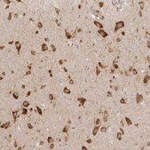 Anti-EEF1E1 antibody produced in rabbit Prestige Antibodies® Powered by Atlas Antibodies, affinity isolated antibody, buffered aqueous glycerol solution
