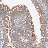 Anti-ZZEF1 antibody produced in rabbit Prestige Antibodies® Powered by Atlas Antibodies, affinity isolated antibody, buffered aqueous glycerol solution, ab2