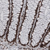 Monoclonal Anti-HNRNPC antibody produced in mouse Prestige Antibodies® Powered by Atlas Antibodies, clone CL2593, purified immunoglobulin, buffered aqueous glycerol solution