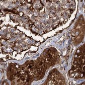 Anti-EML4 antibody produced in rabbit Prestige Antibodies® Powered by Atlas Antibodies, affinity isolated antibody, buffered aqueous glycerol solution