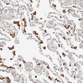 Anti-ZRANB1 antibody produced in rabbit Prestige Antibodies® Powered by Atlas Antibodies, affinity isolated antibody, buffered aqueous glycerol solution, ab3