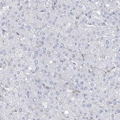 Anti-NKX6-1 antibody produced in rabbit Prestige Antibodies® Powered by Atlas Antibodies, affinity isolated antibody, buffered aqueous glycerol solution