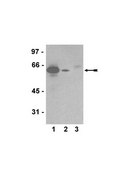 Anti-Akt1/PKBα Antibody, clone AW24, rabbit monoclonal clone AW24, Upstate®, from rabbit
