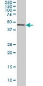 Monoclonal Anti-CSNK1G1 antibody produced in mouse clone 2E10, purified immunoglobulin, buffered aqueous solution