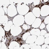 Anti-TFRC antibody produced in rabbit Prestige Antibodies® Powered by Atlas Antibodies, affinity isolated antibody, buffered aqueous glycerol solution