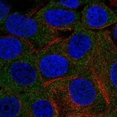 Anti-PHKG2 antibody produced in rabbit Prestige Antibodies® Powered by Atlas Antibodies, affinity isolated antibody
