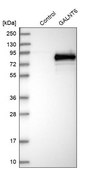 Anti-GALNT6 antibody produced in rabbit Prestige Antibodies® Powered by Atlas Antibodies, affinity isolated antibody, buffered aqueous glycerol solution, Ab1