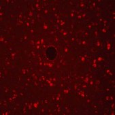 Autofluorescence Eliminator Reagent Autofluorescence Eliminator Reagent for IHC.