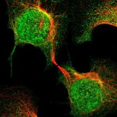 Anti-MED21 antibody produced in rabbit Prestige Antibodies® Powered by Atlas Antibodies, affinity isolated antibody, buffered aqueous glycerol solution