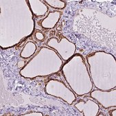 Anti-PRKCSH antibody produced in rabbit Prestige Antibodies® Powered by Atlas Antibodies, affinity isolated antibody, buffered aqueous glycerol solution