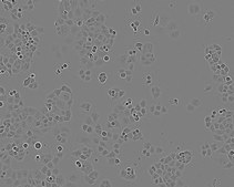 PANC-1 Cell Line human NOTE: Both the cell line and DNA from the cell line may be available for this product. Please choose -1VL or VIAL for cells, or -DNA-5UG for DNA, 87092802, human pancreas, Epithelial