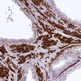 Anti-SYNPO2 antibody produced in rabbit Prestige Antibodies® Powered by Atlas Antibodies, affinity isolated antibody, buffered aqueous glycerol solution