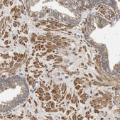 Anti-PPM1B antibody produced in rabbit Prestige Antibodies® Powered by Atlas Antibodies, affinity isolated antibody, buffered aqueous glycerol solution