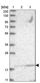Anti-UBE2F antibody produced in rabbit Prestige Antibodies® Powered by Atlas Antibodies, affinity isolated antibody, buffered aqueous glycerol solution