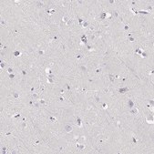 Anti-GPR174 antibody produced in rabbit Prestige Antibodies® Powered by Atlas Antibodies, affinity isolated antibody, buffered aqueous glycerol solution