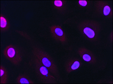 抗HMGB1 (HMG1) (N-末端) ウサギ宿主抗体 affinity isolated antibody, buffered aqueous solution