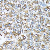 Anti-Cytochrome P450 4A (CYP4A11) Antibody, clone 10D10W7, Rabbit Monoclonal
