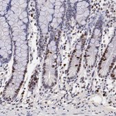 Anti-MKI67 antibody produced in rabbit Ab1, Prestige Antibodies® Powered by Atlas Antibodies, affinity isolated antibody, buffered aqueous glycerol solution