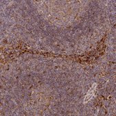 Anti-LGALS9 antibody produced in rabbit Prestige Antibodies® Powered by Atlas Antibodies, affinity isolated antibody, buffered aqueous glycerol solution