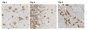 Anti-Tankyrase-1/TNKS Antibody, clone 7D1.2 clone 7D1.2, from mouse