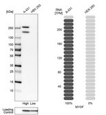 Anti-MYOF antibody produced in rabbit Prestige Antibodies® Powered by Atlas Antibodies, affinity isolated antibody, buffered aqueous glycerol solution