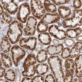 Anti-DHRS4 antibody produced in rabbit Prestige Antibodies® Powered by Atlas Antibodies, affinity isolated antibody, buffered aqueous glycerol solution