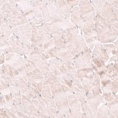 Anti-NELL1 antibody produced in rabbit Prestige Antibodies® Powered by Atlas Antibodies, affinity isolated antibody, buffered aqueous glycerol solution
