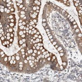 Anti-KIF1C antibody produced in rabbit Prestige Antibodies® Powered by Atlas Antibodies, affinity isolated antibody, buffered aqueous glycerol solution, Ab2