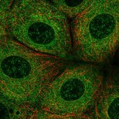 Anti-SLC27A3 antibody produced in rabbit Prestige Antibodies® Powered by Atlas Antibodies, affinity isolated antibody, buffered aqueous glycerol solution