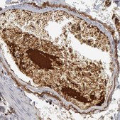 Anti-C1QC antibody produced in rabbit Prestige Antibodies® Powered by Atlas Antibodies, affinity isolated antibody, buffered aqueous glycerol solution