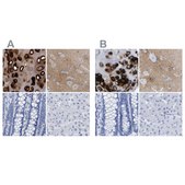 Anti-HAPLN1 antibody produced in rabbit Prestige Antibodies® Powered by Atlas Antibodies, affinity isolated antibody, buffered aqueous glycerol solution, Ab2