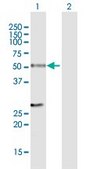 Anti-RAD23B antibody produced in mouse IgG fraction of antiserum, buffered aqueous solution