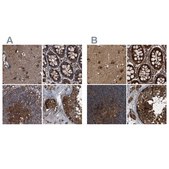 Anti-PEX5 antibody produced in rabbit Prestige Antibodies® Powered by Atlas Antibodies, affinity isolated antibody, buffered aqueous glycerol solution